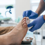 Piede diabetico: la prevenzione quotidiana che può salvare mobilità e qualità di vita